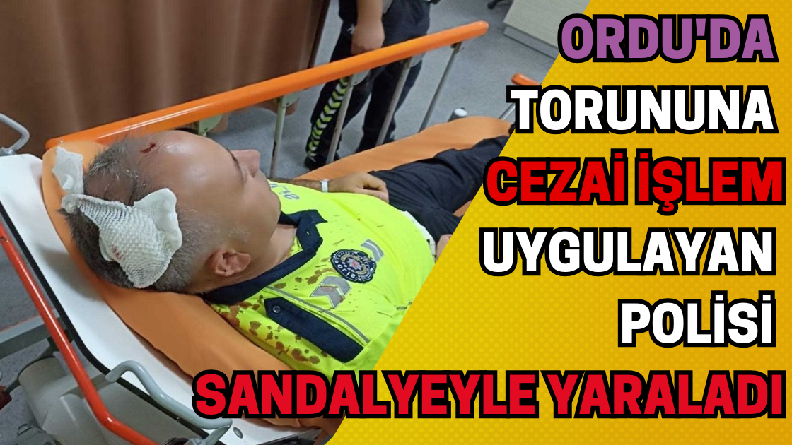 Ordu'da Torununa Cezai İşlem Uygulayan Polisi Sandalyeyle Yaraladı