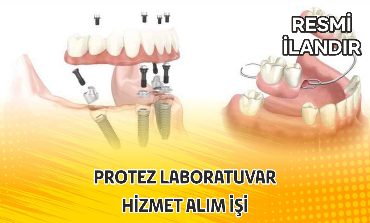 PROTEZ LABORATUVAR  HİZMET ALIM İŞİ